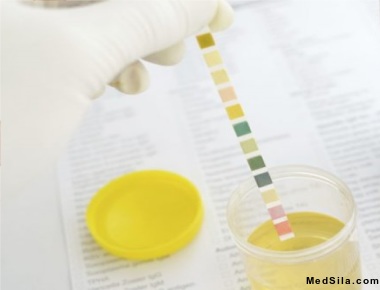 Анализ мочи